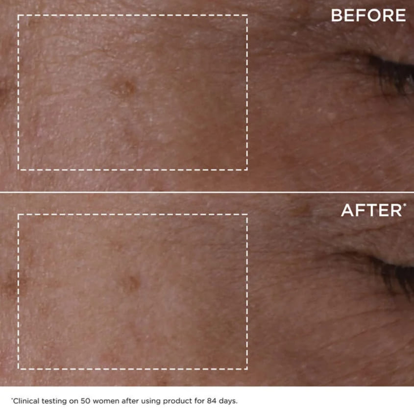 Double Serum
