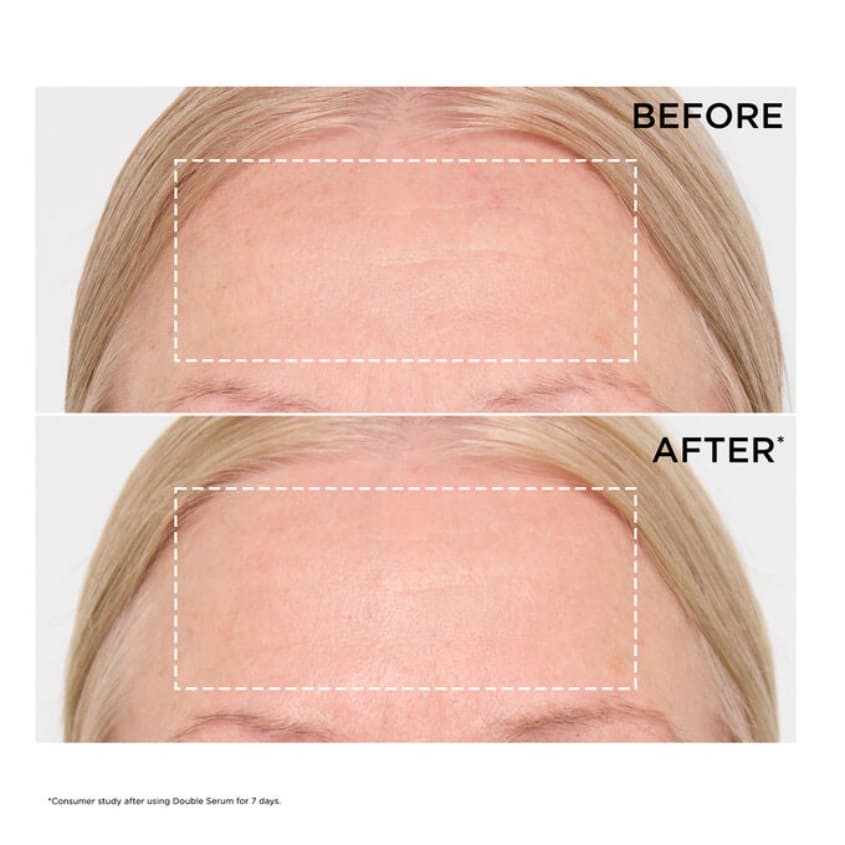 Double Serum