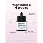 The Niacinamide 15 Serum