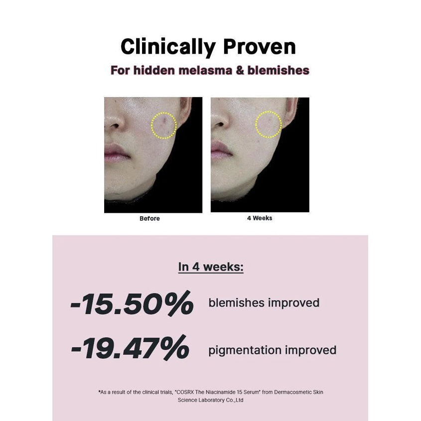 The Niacinamide 15 Serum