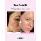 The Niacinamide 15 Serum