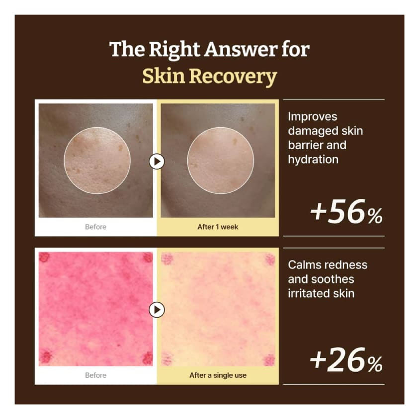 ADVANCED PDRN REJUVENATING CREAM RENEWAL, 20 ML