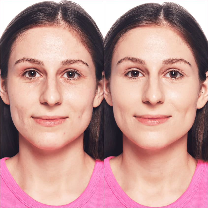 I Love Flawless Skin Foundation