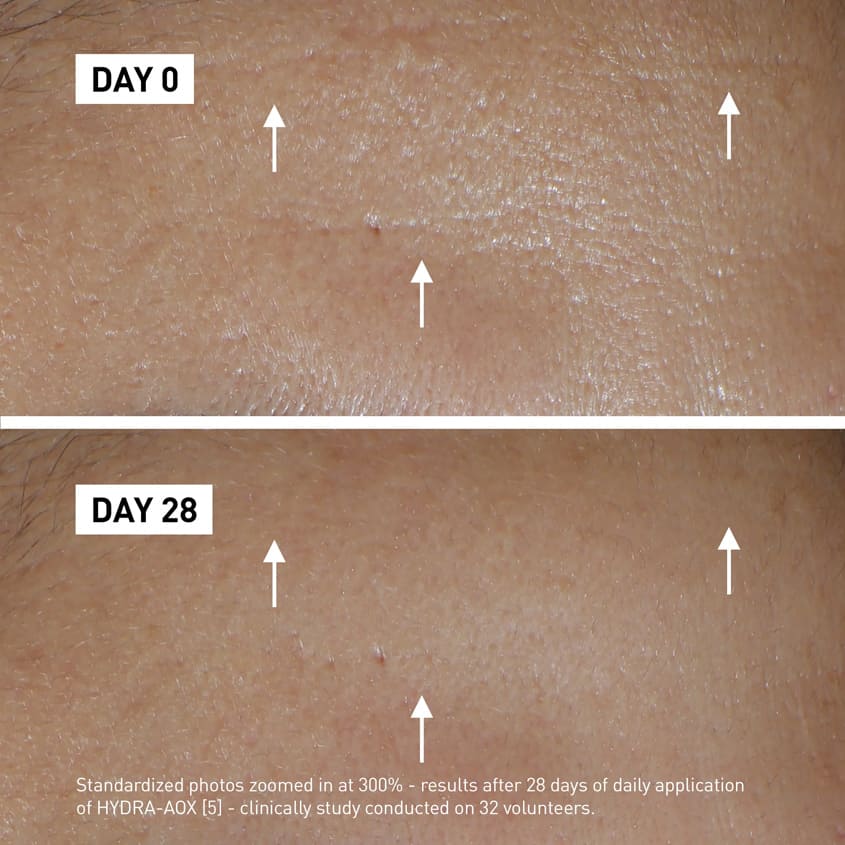 Hydra-Aox [5] Intensive Antioxidant Serum