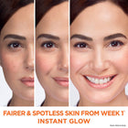 SkinActive Fast Bright Vitamin C Day Cream with UV Filter