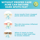 SkinActive Fast Clear Booster Serum with Salicylic Acid