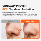 Pore Cleansing Oil AHA