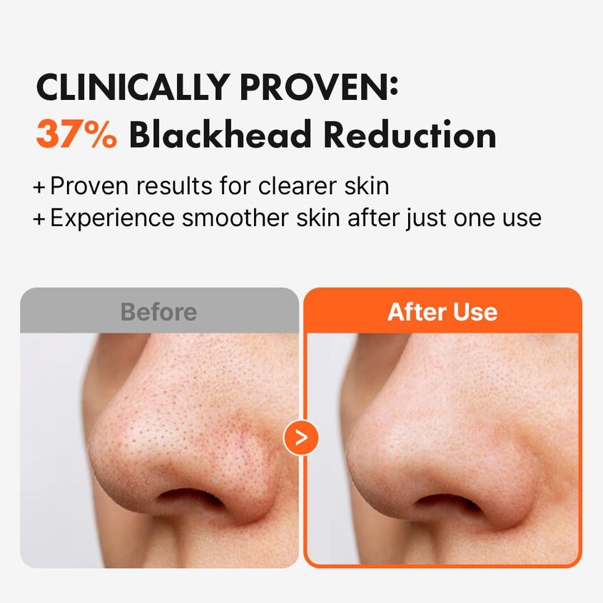 Pore Cleansing Oil AHA