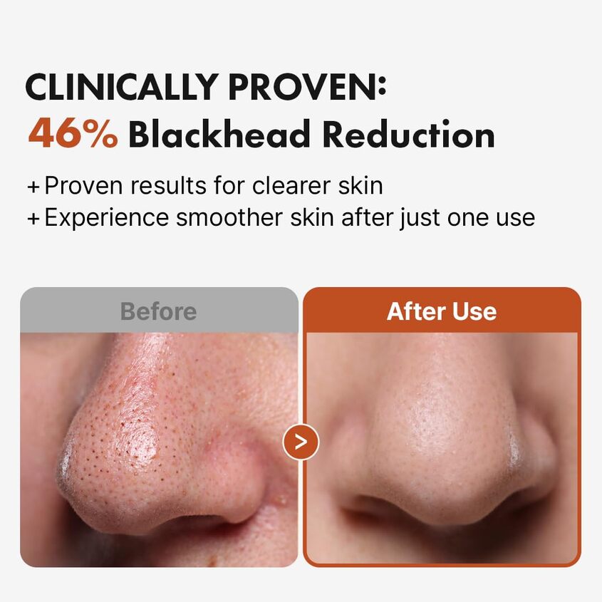 HANSKIN PORE CLEANSING OIL BHA 300ML – free delivery