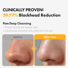 Pore Cleansing Oil PHA