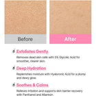 Real Complexion Hyaluron Exfoliating AHA Treatment