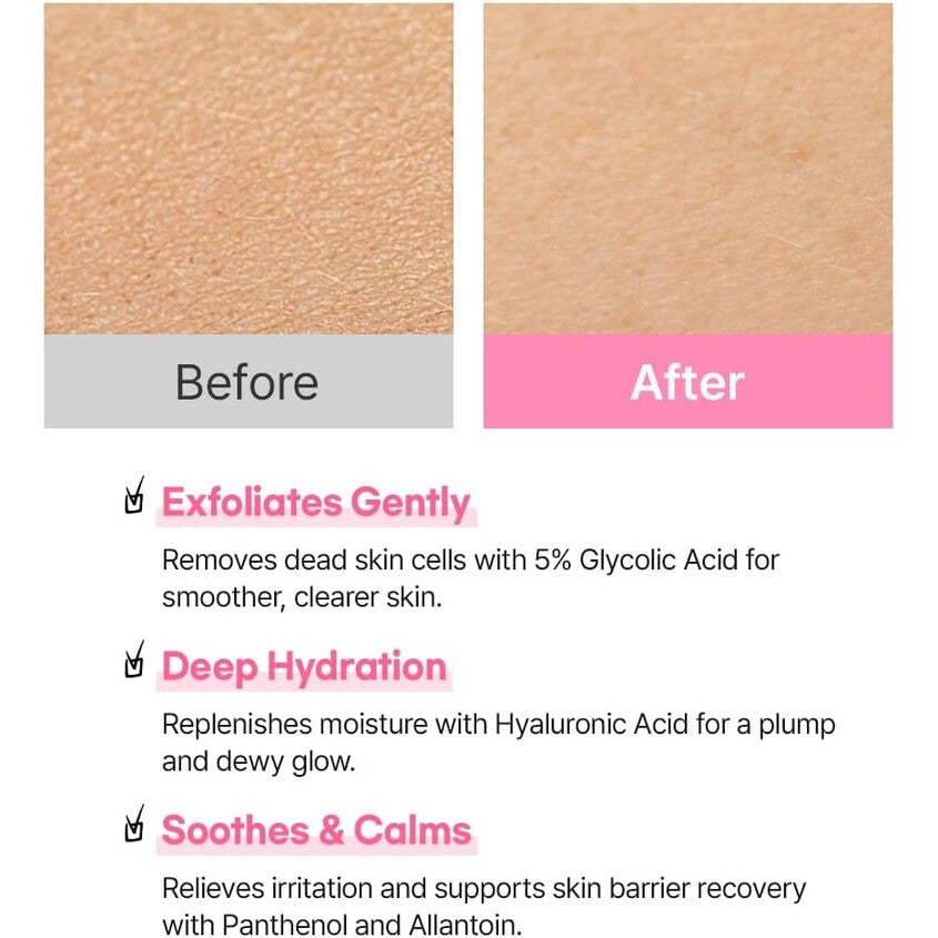 Real Complexion Hyaluron Exfoliating AHA Treatment