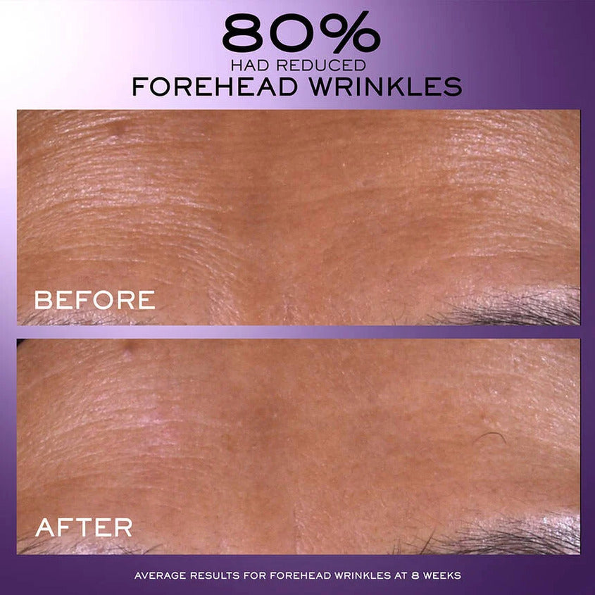 Rénergie C.R.x. Triple Serum Retinol