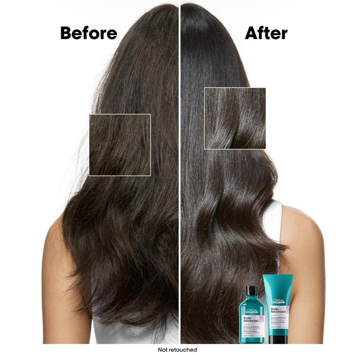Serie Expert Scalp Advanced Anti-Discomfort Dermo-Regulator Shampoo