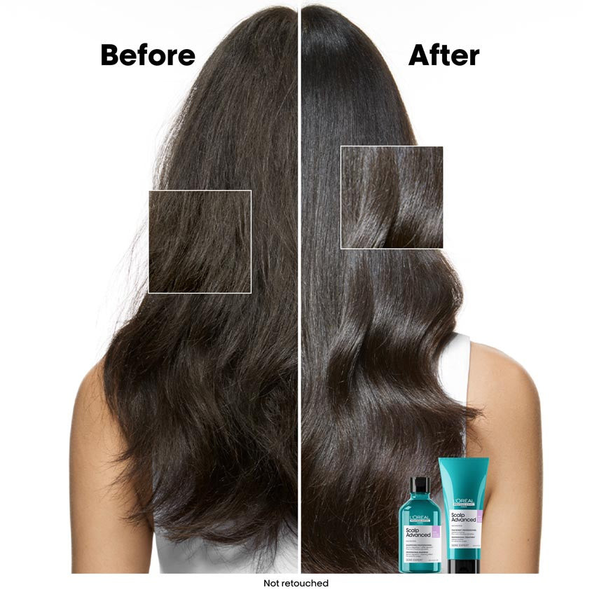 Serie Expert Scalp Advanced Anti-Discomfort Dermo-Regulator Shampoo