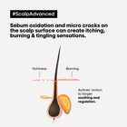 Serie Expert Scalp Advanced Anti-Discomfort Intense Soother Treatment