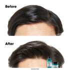 L'OREAL PROFESSIONNEL ANTI-OILINESS SHAMPOO, 300ML – صورة 6