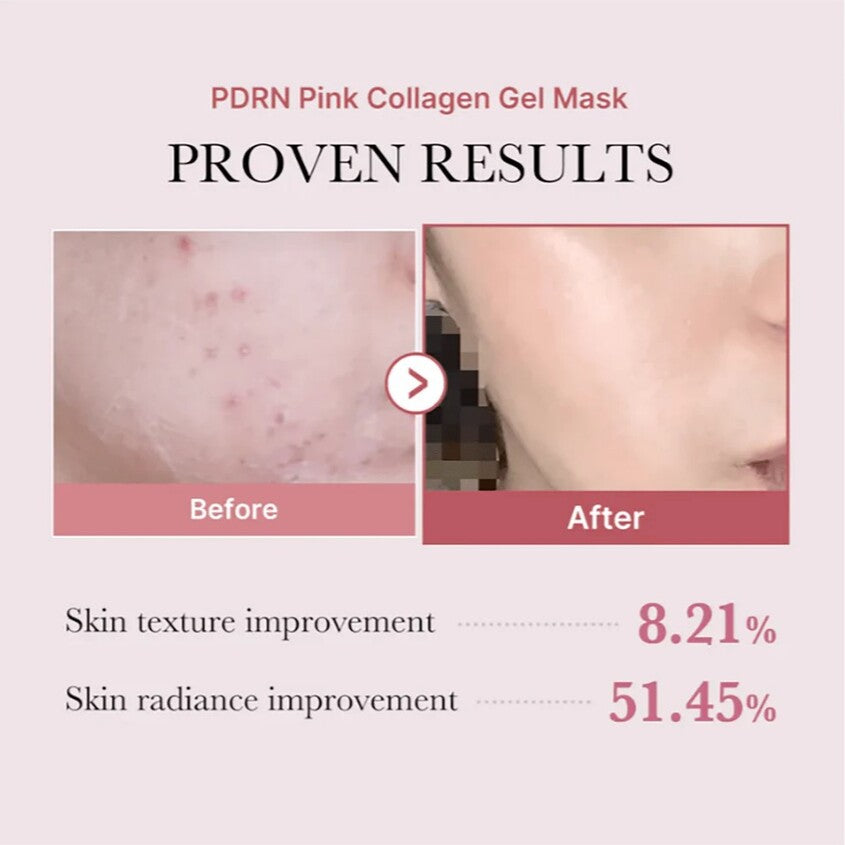 MEDICUBE PDRN PINK COLLAGEN GEL MASK 28G – متجر إلكتروني