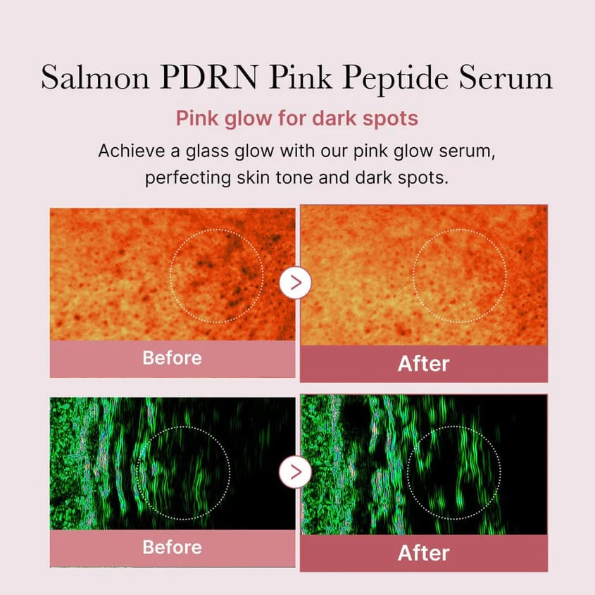 Medicube PDRN Pink Peptide Serum 30ml – free delivery