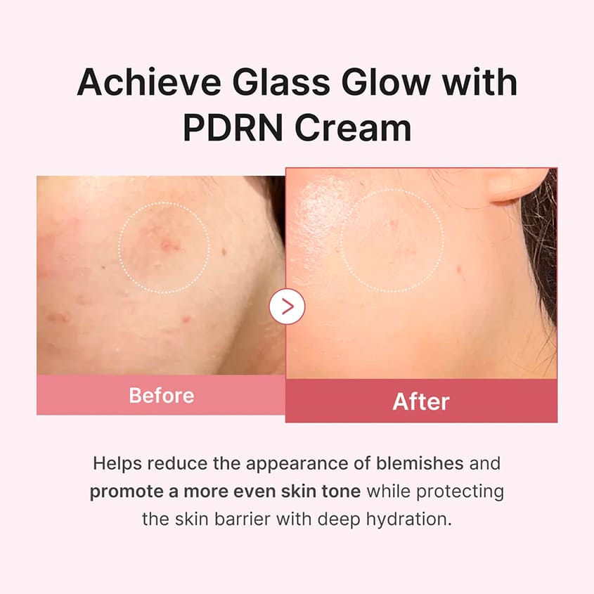 MEDICUBE PDRN PINK HYALURONIC MOISTURIZING CREAM, 50 ML