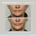 Trinity Lip & Eye Enhancer Attachment