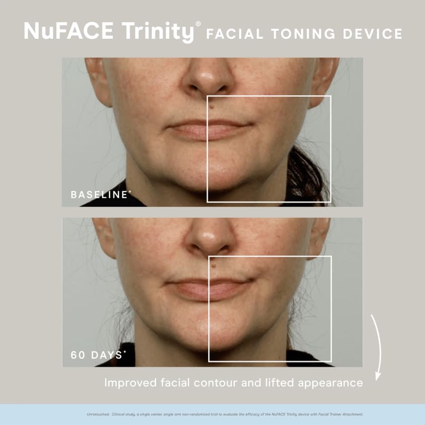 Trinity Lip & Eye Enhancer Attachment