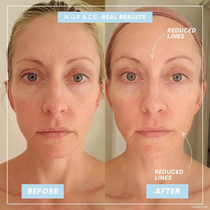 Trinity Wrinkle Reducer Attachment