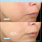 Trinity+ Effective Lip & Eye Attachment