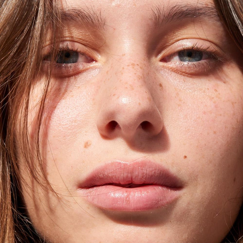 Pâte Grisе Blackhead Solution