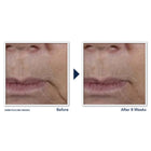 Multi Correxion® Firm + Lift Anti-Sagging Firming Cream