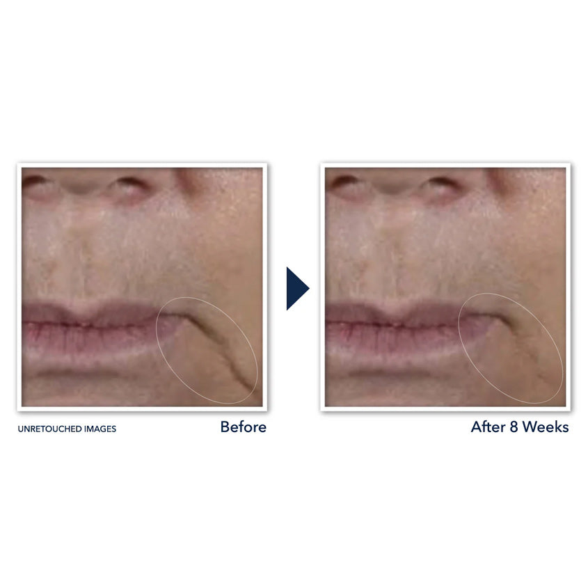 Multi Correxion® Firm + Lift Anti-Sagging Firming Cream
