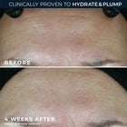 Multi Correxion® Hydrate + Plump Moisturizer SPF 30