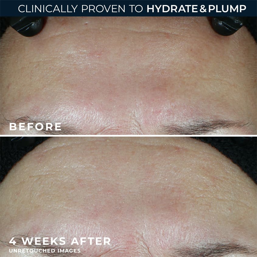 Multi Correxion® Hydrate + Plump Moisturizer SPF 30