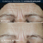 Multi Correxion® Hydrate + Plump Moisturizer SPF 30