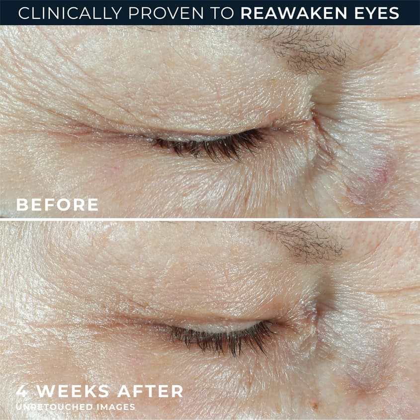Multi Correxion® Hydrate + Plump Eye Cream
