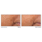 Retinol Correxion® Line Smoothing Night Serum Capsules