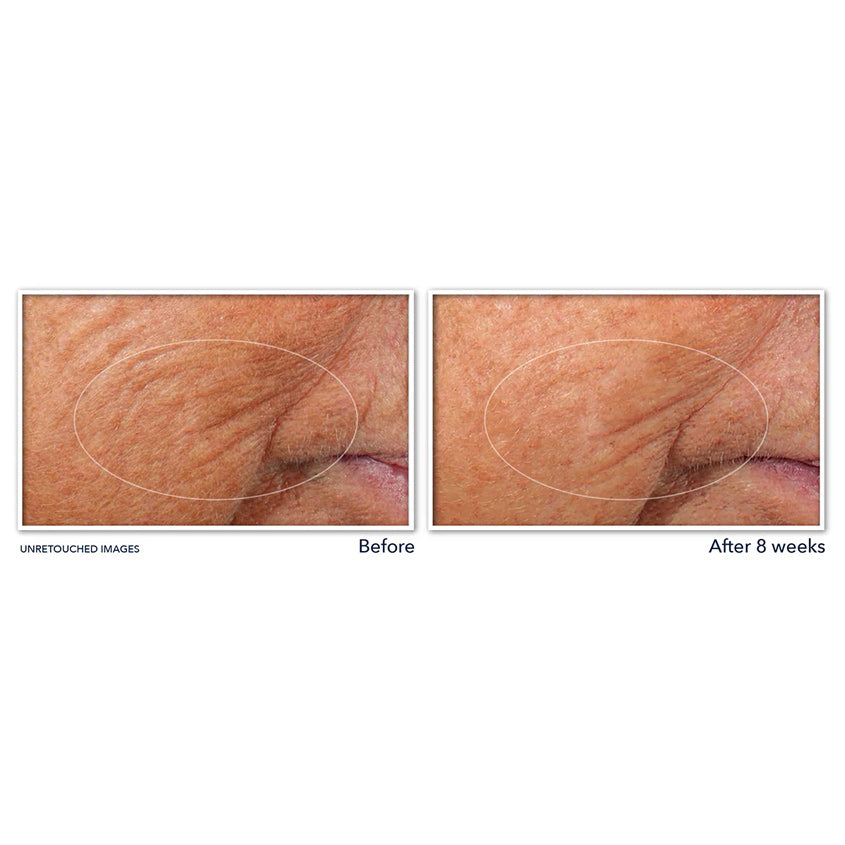 Retinol Correxion® Line Smoothing Night Serum Capsules