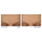 ROC RETINOL CORREXION LINE SMOOTHING MAX HYDRATION 50ML – free delivery