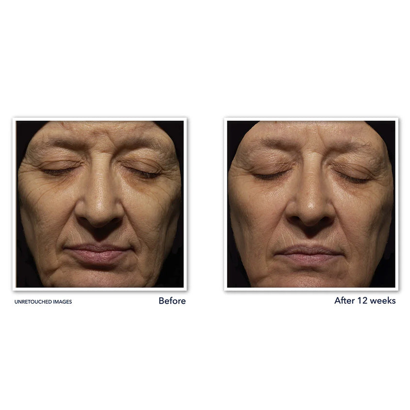 Retinol Correxion® Wrinkle Correct Night Cream