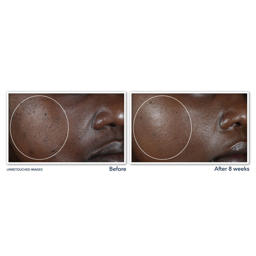 Multi Correxion® Even Tone + Lift Night Cream