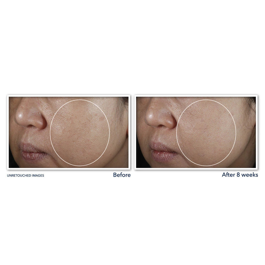 Multi Correxion® Even Tone + Lift Night Cream