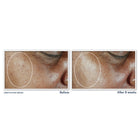 Multi Correxion® Even Tone + Lift Daily Moisturizer SPF 30