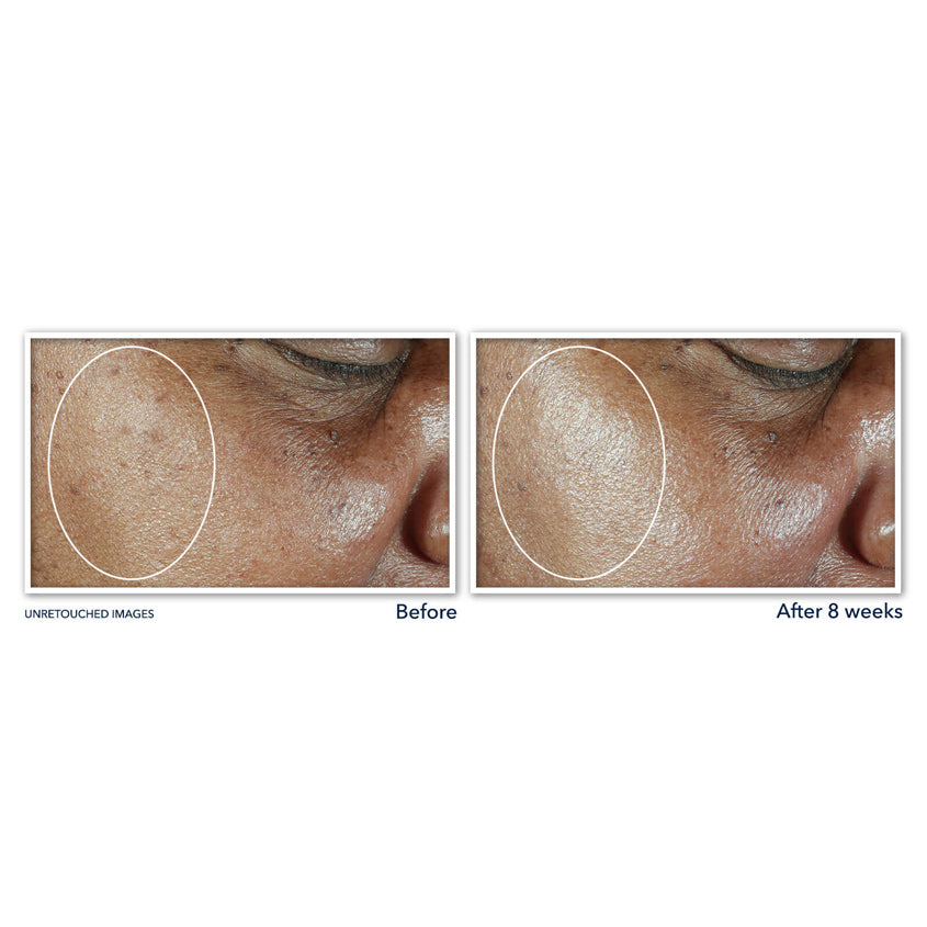 Multi Correxion® Even Tone + Lift Daily Moisturizer SPF 30