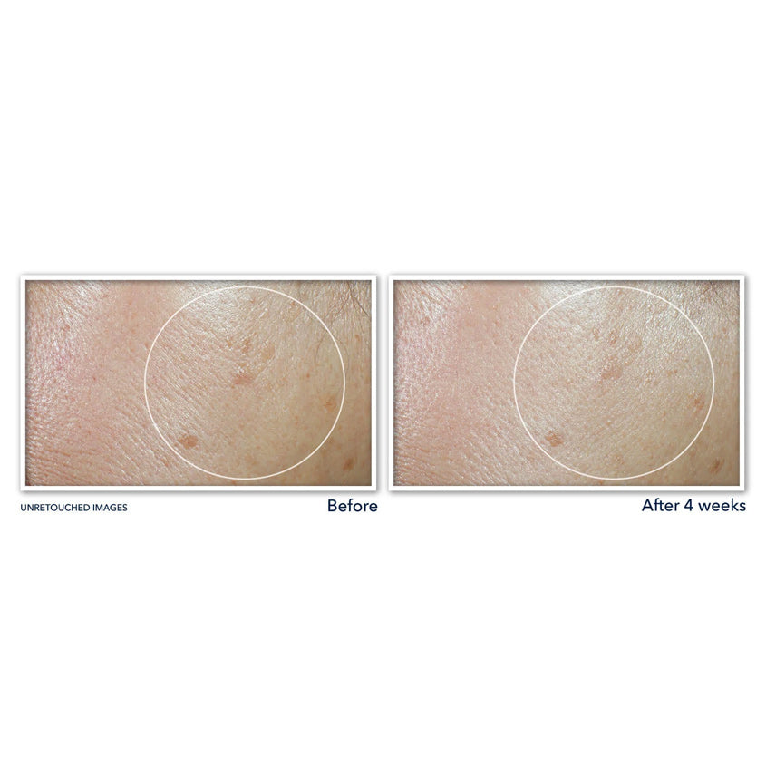 Multi Correxion® Even Tone + Lift Daily Moisturizer SPF 30
