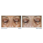 Multi Correxion® Even Tone + Lift Eye Cream