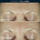 Derm Correxion® Fill + Treat Serum