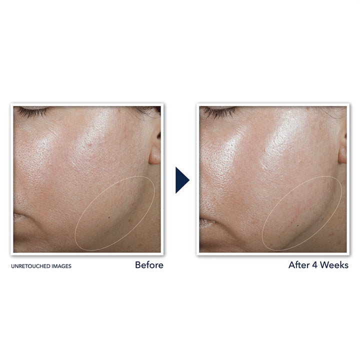 DERM CORREXION CONTOUR CREAM 50ML