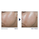 Derm Correxion® Contour Cream