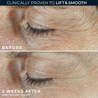Derm Correxion® Dual Eye Cream
