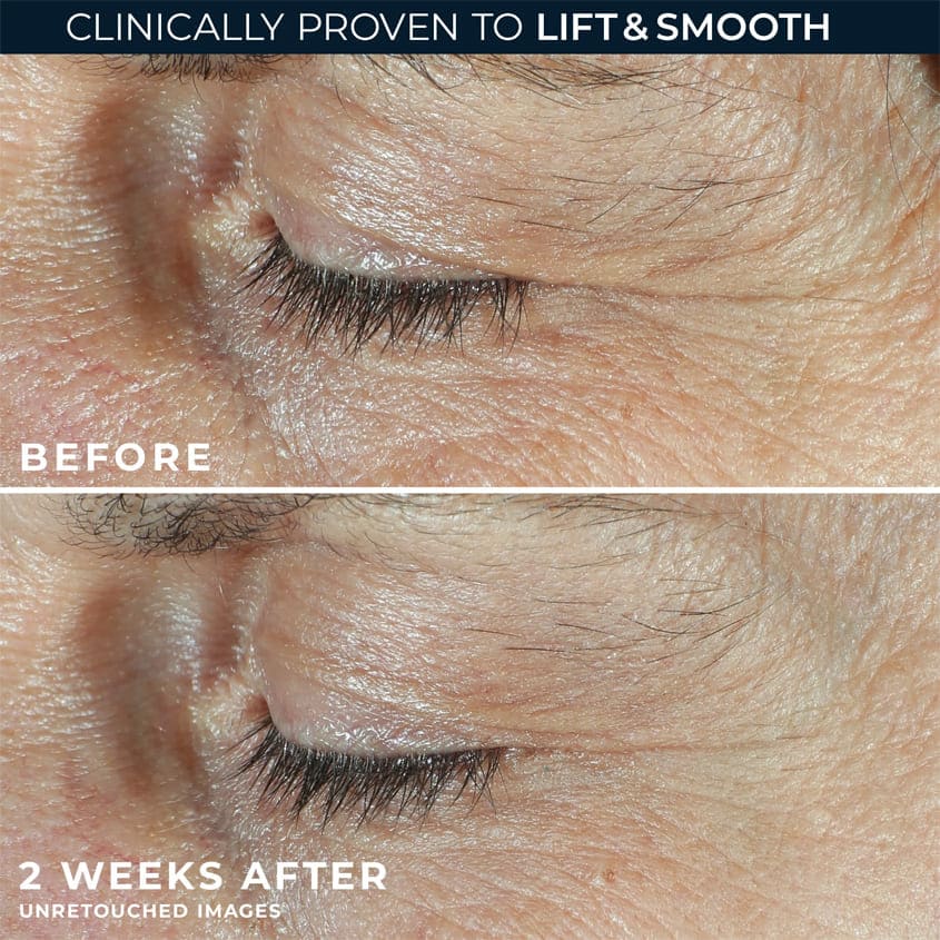 Derm Correxion® Dual Eye Cream
